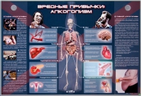 Электрифицированный стенд "Вредные привычки: алкоголизм" - «globural.ru» - Астрахань