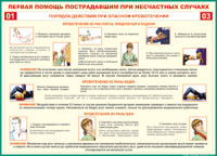 Таблица Порядок действий при опасном кровотечении 1000*1400 винил - «globural.ru» - Астрахань